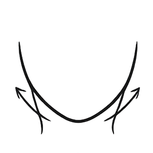Acide Hyaluronique Jawline