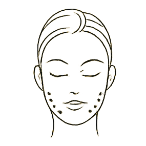 Radiesse ovale du visage