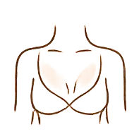Traitement vasculaire décolleté